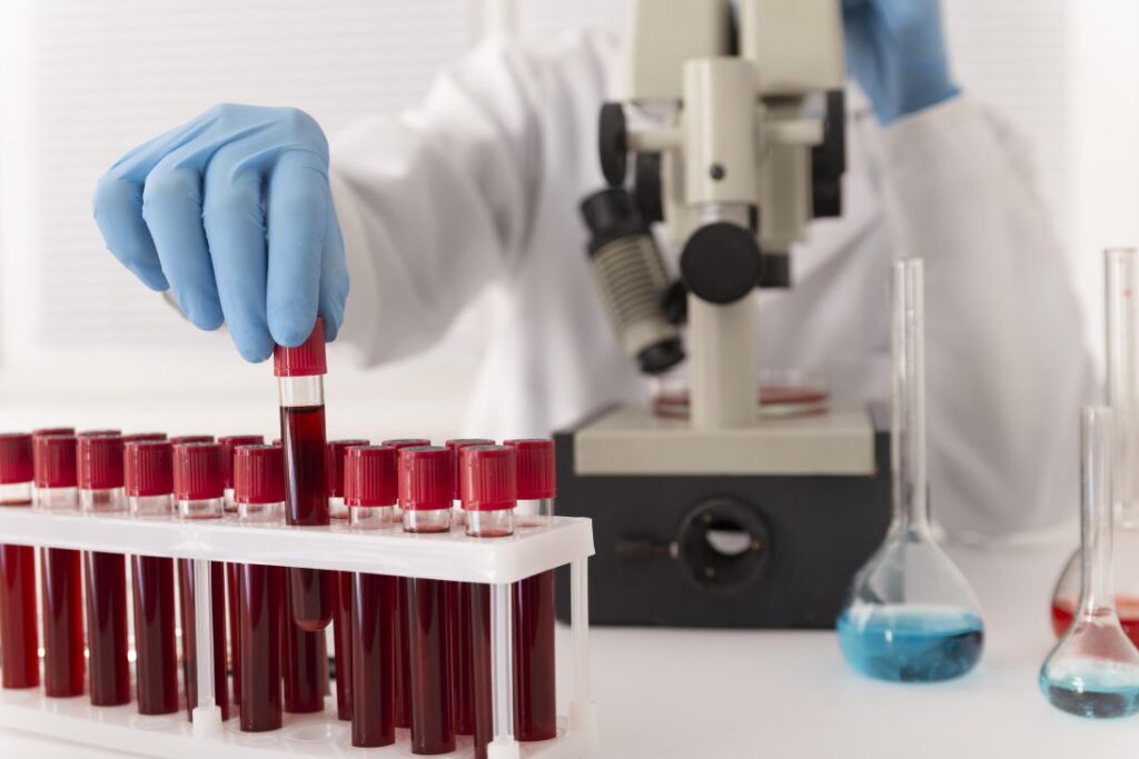 blood samples arrangement lab