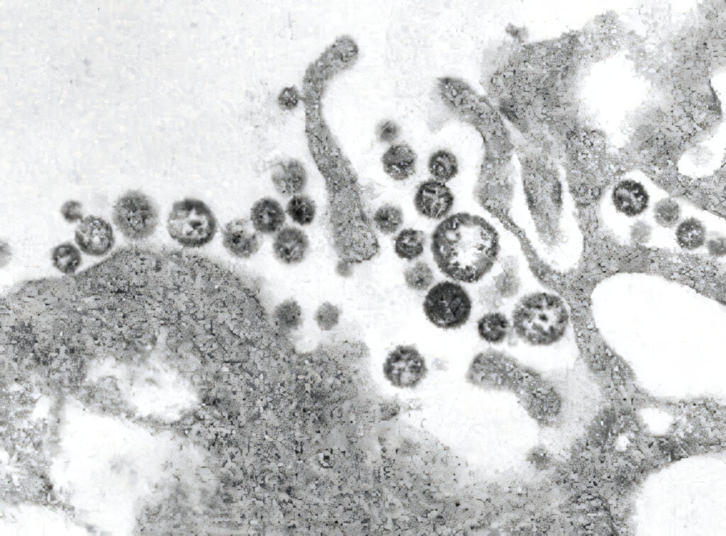 Lassa Fever Virus
